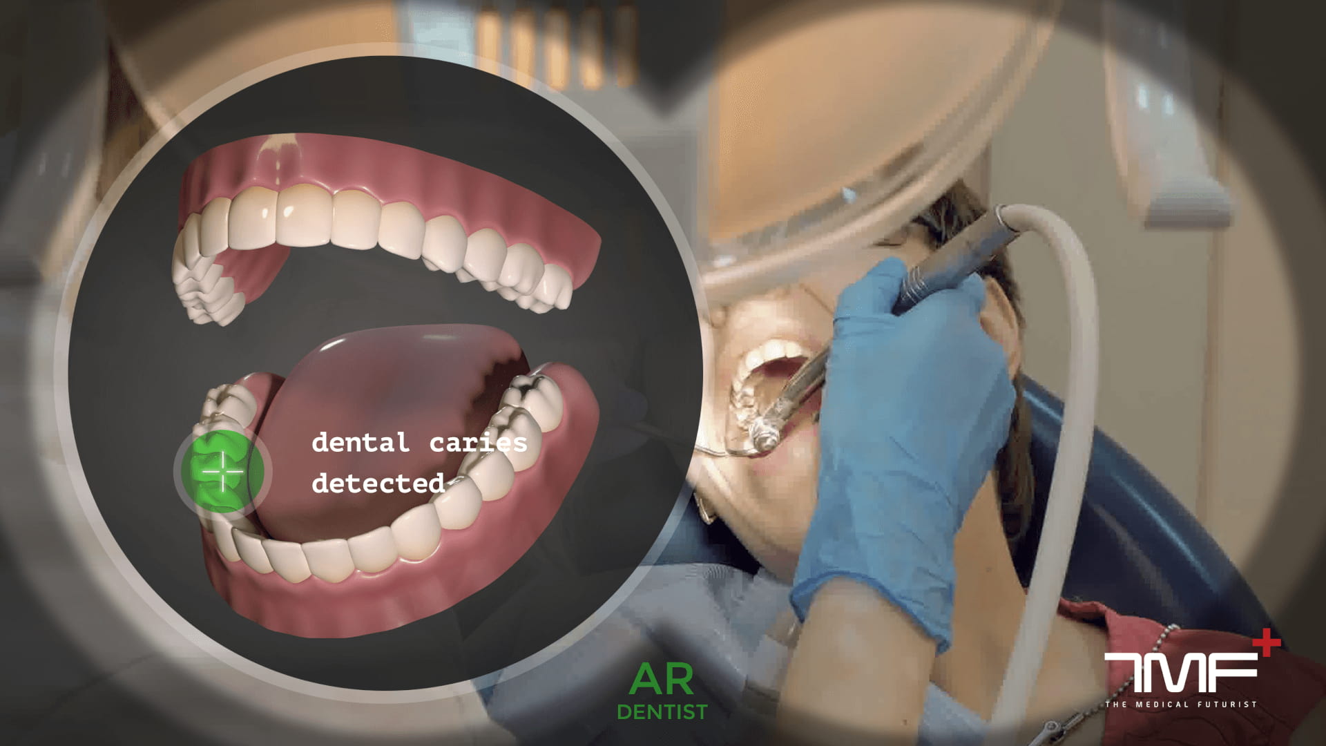 Augmented reality in dental diagnostics