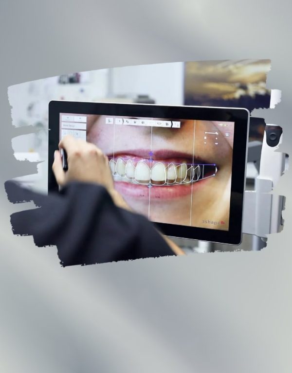 AR Smile Application - miniature