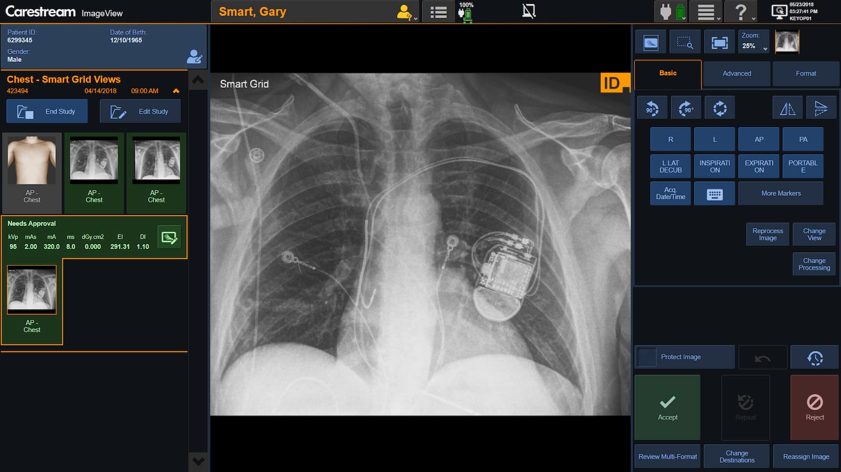 Medical imaging software example